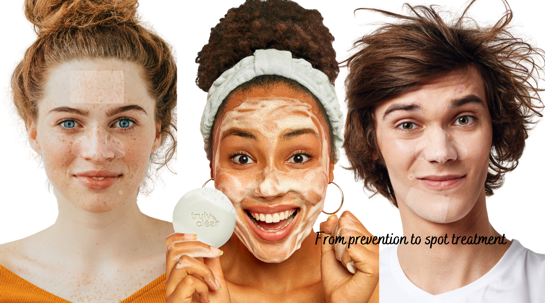 Comprehensive Care: From prevention to spot treatment, Truly Clear has a solution for every summer skin woe. - Truly Clear