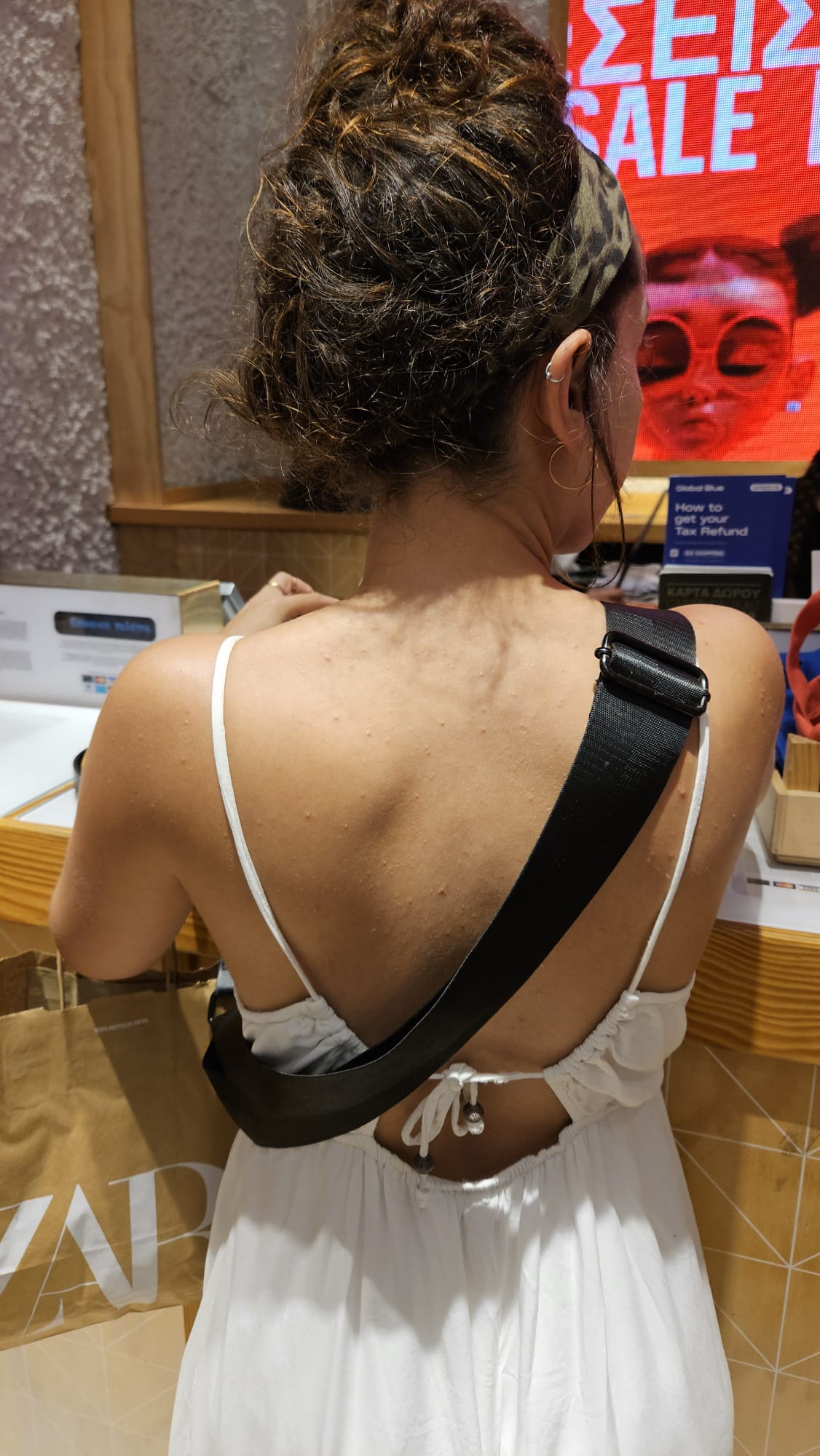 Summer Solutions: Banish Back Acne with Truly Clear - Truly Clear