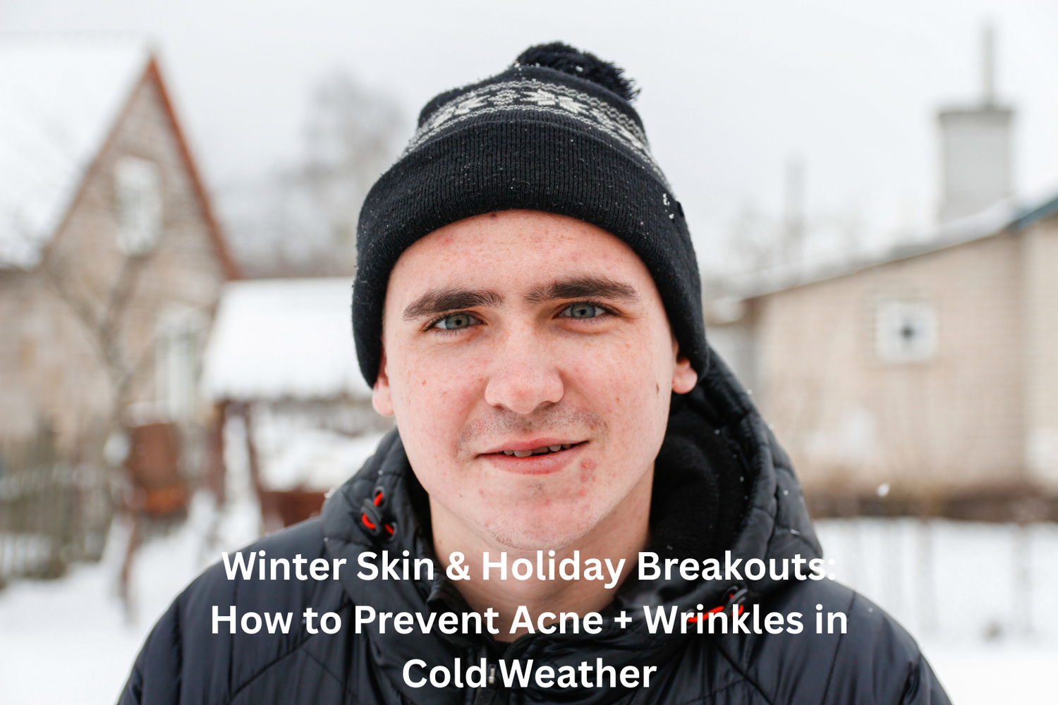 Winter Skin & Holiday Breakouts: How to Prevent Acne + Wrinkles in Cold Weather
