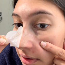 Truly Clear Ultimate Set – Complete Acne Solution Bundle