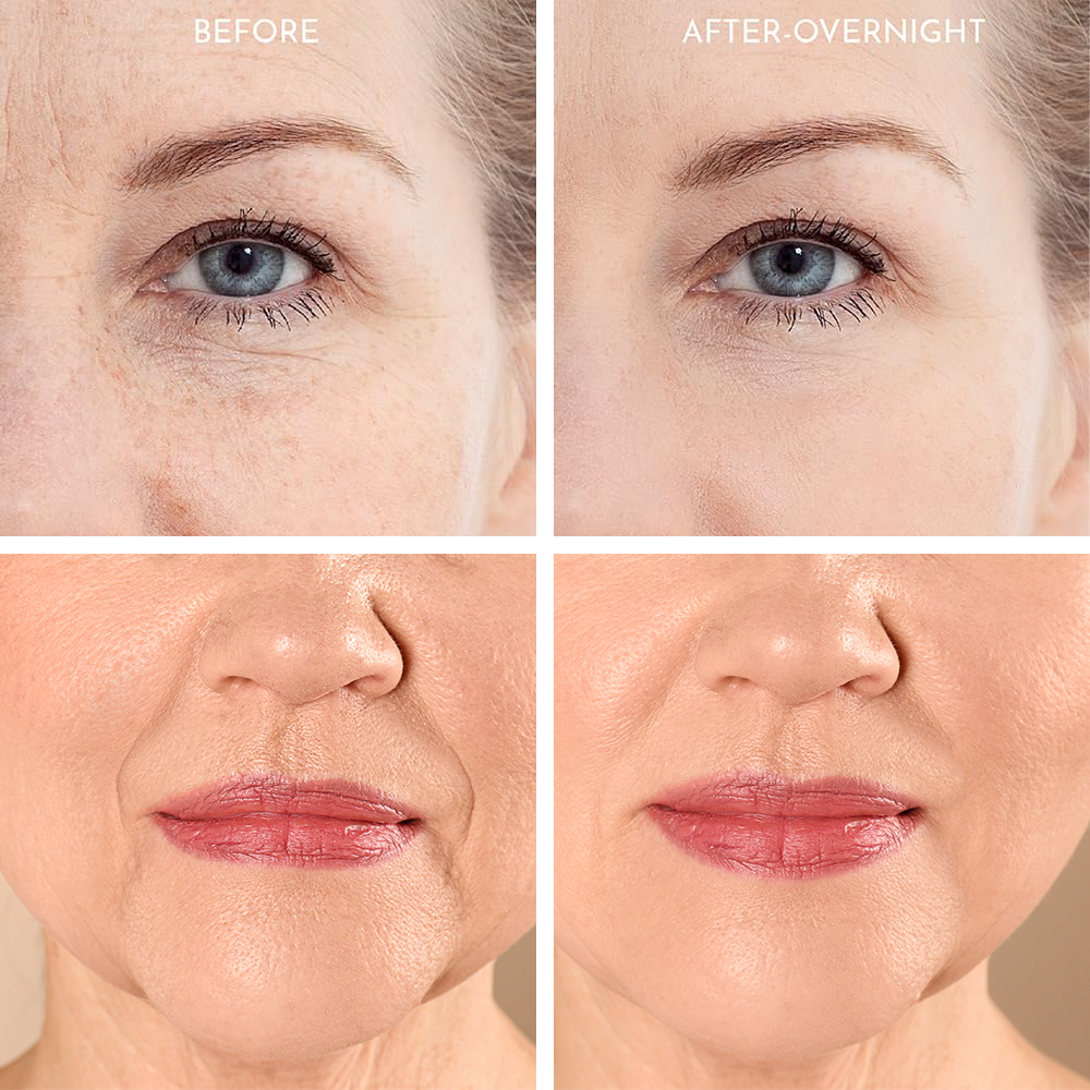 Truly Clear Wrinkle Fighting Silicone 3 Piece Face Set