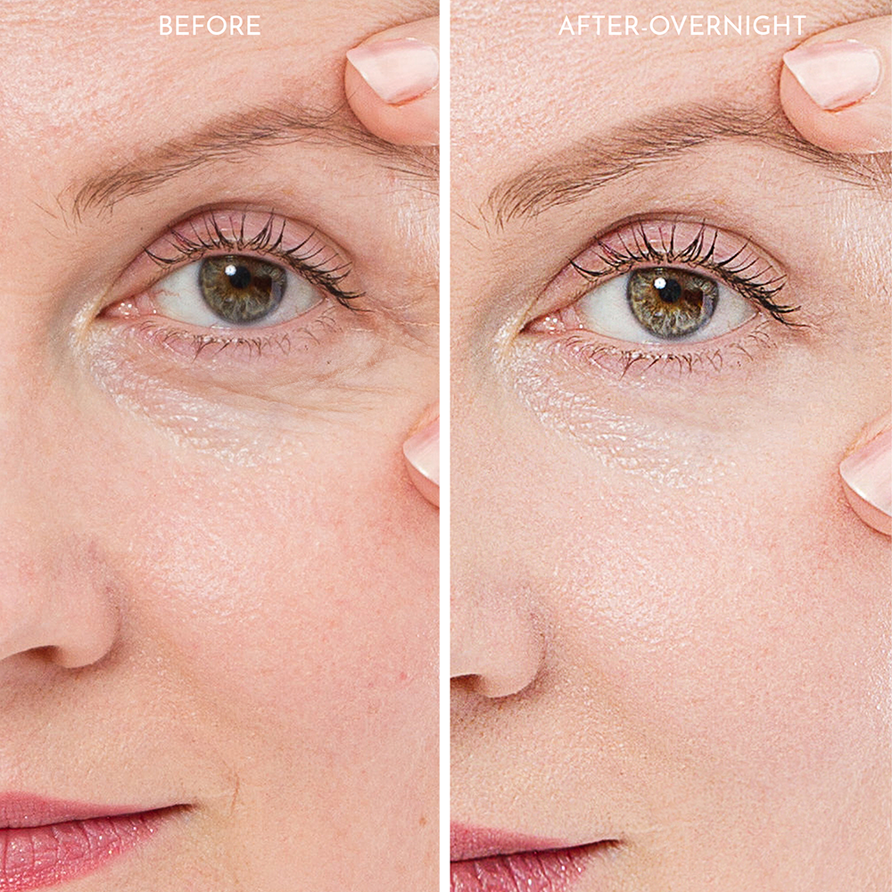 Truly Clear Wrinkle Fighting Silicone 3 Piece Face Set