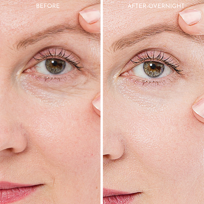 Truly Clear Wrinkle Fighting Silicone 3 Piece Face Set