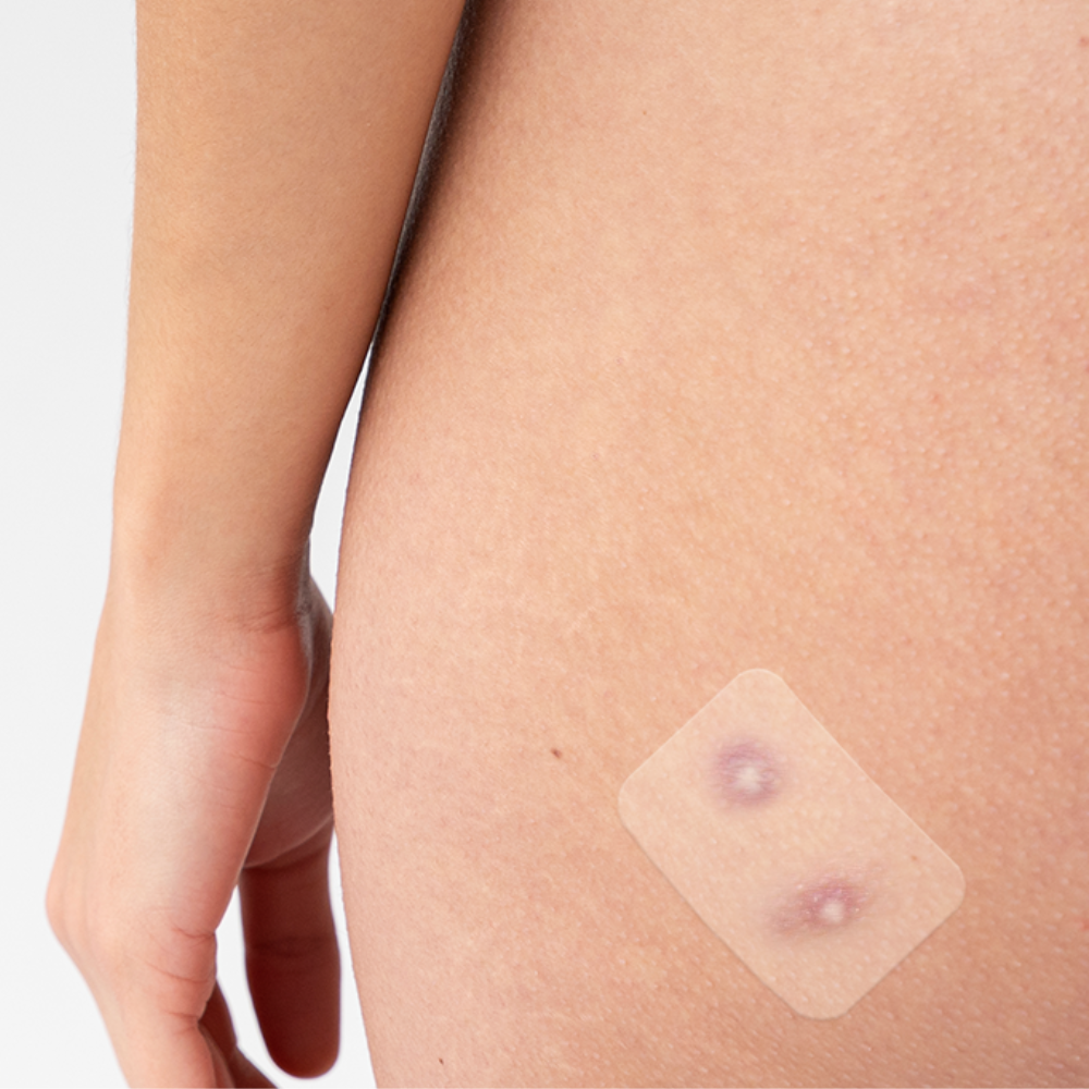Truly Clear Hydrocolloid Target Patches